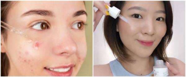 Manfaat serum Somethinc untuk jerawat, ini 5 jenis yang bisa kamu coba