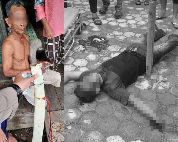 Terungkap! Kronologis Duel Berdarah di Parigi Tapin hingga Putuskan Lengan Pemuda Banua Padang