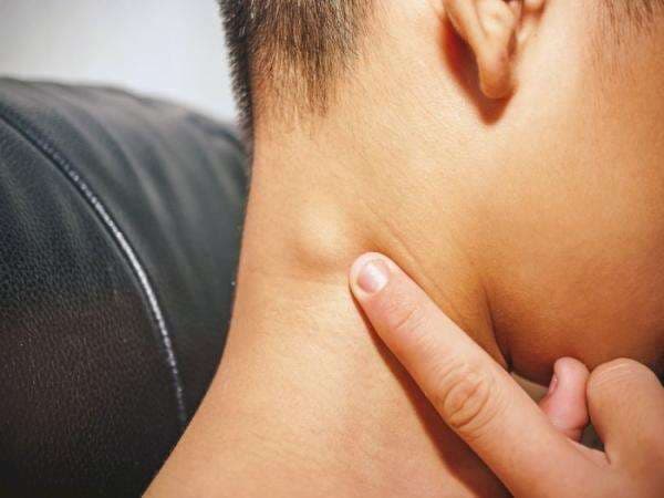 Kelenjar Getah Bening: Penyebab, Ciri-Ciri, dan Cara Mengobatinya