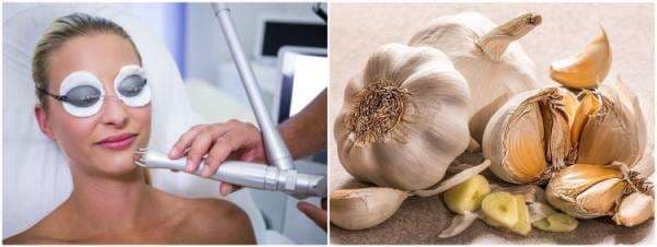 11 Cara menghilangkan kutil di wajah, pakai bahan alami dan teknologi