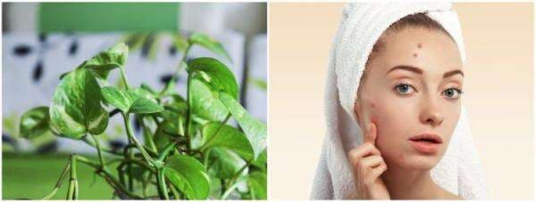 8 Manfaat daun sirih cina untuk wajah, bantu memudarkan flek hitam