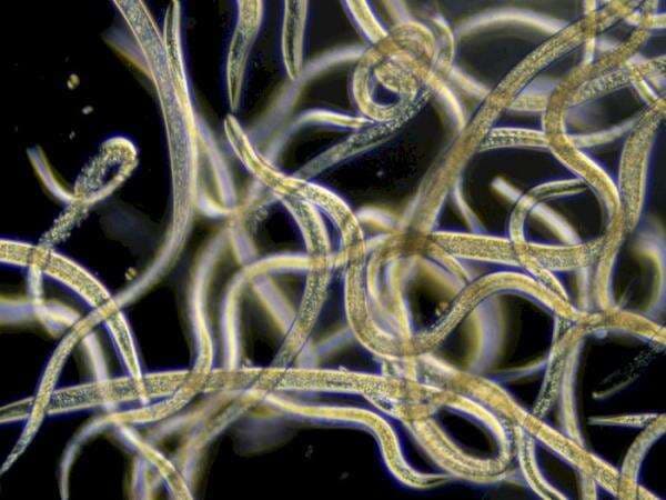 Keren, Cacing Kecil Ini Cuma Punya 300 Sel Otak, Tapi Bisa Berperilaku Sangat Pintar!