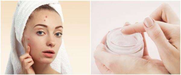7 Skincare Viva untuk mengatasi kulit berjerawat, wajah jadi halus