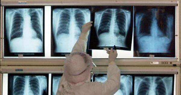 Menilik Teknologi X-ray Terbaru Fuji Film, Pengambilan Foto Rontgen Lebih Cepat