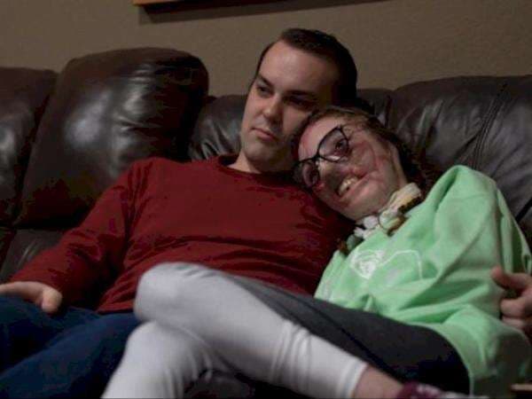 Pria Ini Tetap Setia Meski Wajah Pacarnya Cacat Usai Digigit Anjing 800 Kali