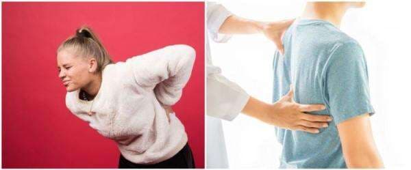 Skoliosis adalah kelainan tulang belakang, ini gejala dan penyebabnya