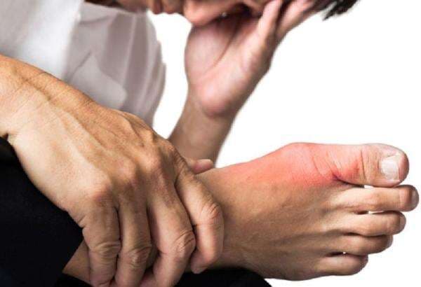 Kaki Bengkak karena Diabetes? Berikut Cara Mengatasinya