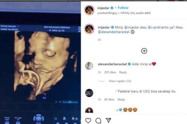 Jessica Iskandar Pamer USG Anak Kedua, Netizen: Ganteng Sedari Kandungan