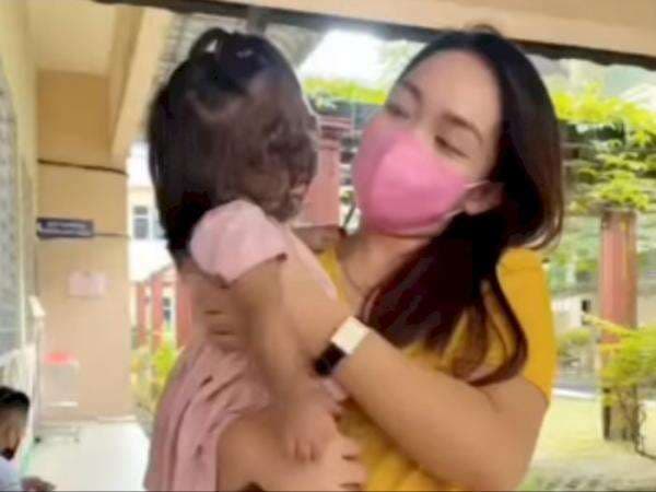 Gejala dan Penyebab Sindrom Manusia Serigala yang Bikin Anak Jadi Berbulu, Bisa Dicegah