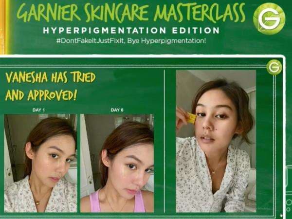 Punya Masalah Hiperpigmentasi Kulit? Garnier Hadirkan Ampoule Serum dengan Formula Vitamin C & Niacinamide