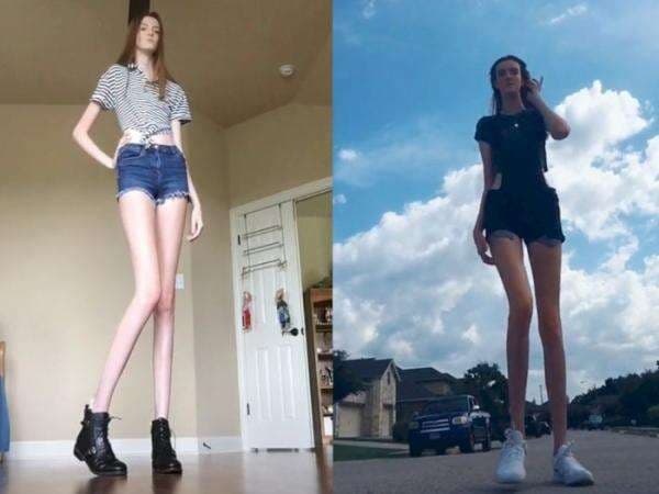 Potret Cantik Maci Currin, Remaja dengan Kaki Terpanjang yang Pecahkan Rekor Dunia