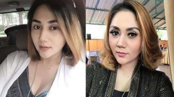 Ingat Pedangdut Aida Saskia yang Dulu Heboh Ngaku Diperkosa KH Zainuddin MZ? Nasibnya Kini Miris...