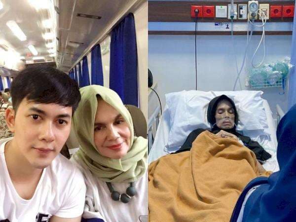 Penyebab Kanker Usus, Penyakit yang Sebabkan Ibunda Kiki Farrel Menjadi Sangat Kurus