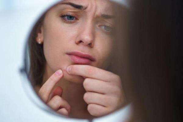 Beautypedia: Kenali Tanda Skin Barrier Rusak, Jangan sampai Terlambat!