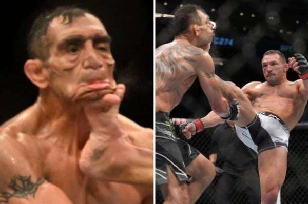 Wajah Rusak Ditendang, Tony Ferguson Dilarang Bertarung Wajah Rusak Ditendang, Tony Ferguson Dilarang Bertarung