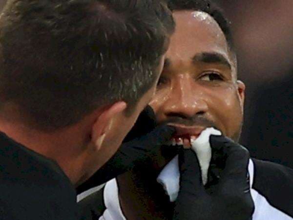 Baru Pulih Cedera Betis, Gigi Striker Newcastle Ini Copot Pula saat Hadapi Arsenal