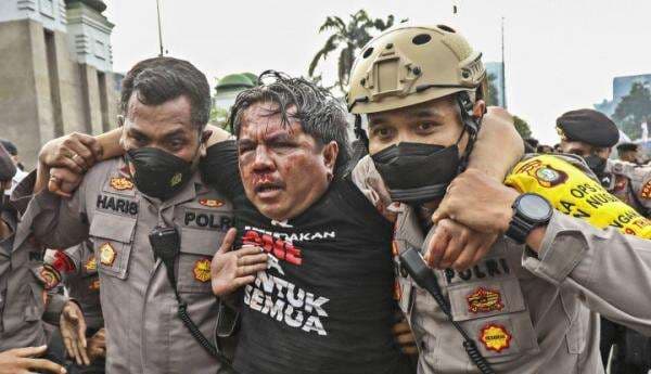 Sempat Babak Belur Dihajar Massa, Ade Armando Berangsur Pulih: Kalau Polisi Terlambat, Saya Mati!