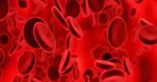 Apa Penyebab Pembuluh Darah Bisa Pecah? Penyakit yang Dikaitkan dengan Hipertensi