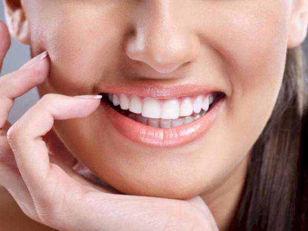 Kenali Bahaya dan Risiko Veneer walau Bikin Gigi Jadi Rapi
