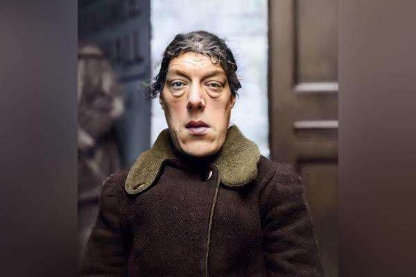 Mary An Bevan, Perawat Rupawan Rela Jadi Wanita Terjelek di Dunia demi Ini