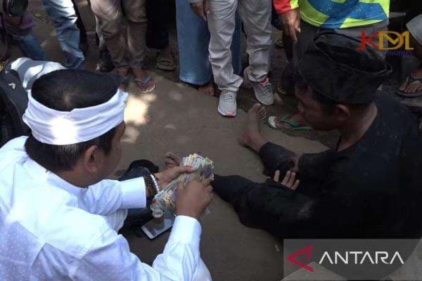 Bertemu Pengemis Pura-pura Kaki Buntung, Dedi Mulyadi Lakukan Ini