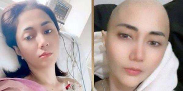 Biodata dan Profil Aida Saskia: Umur, Agama dan Karier, Idap Kanker Payudara dan Pengangkatan Rahim