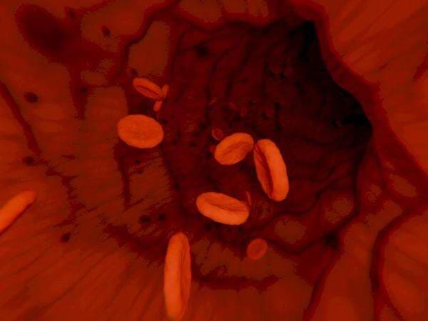 Jumlah Trombosit Normal Orang Dewasa, Anak-Anak, dan Lansia