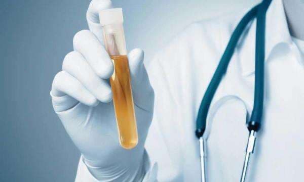 Darah dalam Urine atau Hematuria, Apa Penyebabnya?