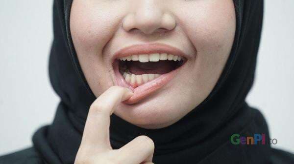 3 Bahan Alami untuk Memutihkan Gigi, Bahan Tersedia di Rumah