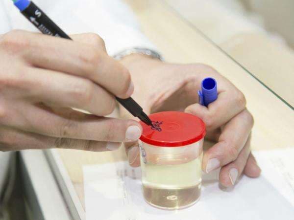 4 Penyebab Kencing Berbusa