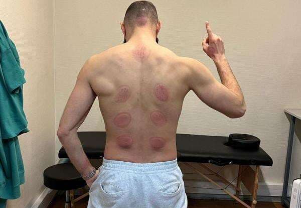 Inilah 5 Contoh Latihan Daya Tahan Tubuh