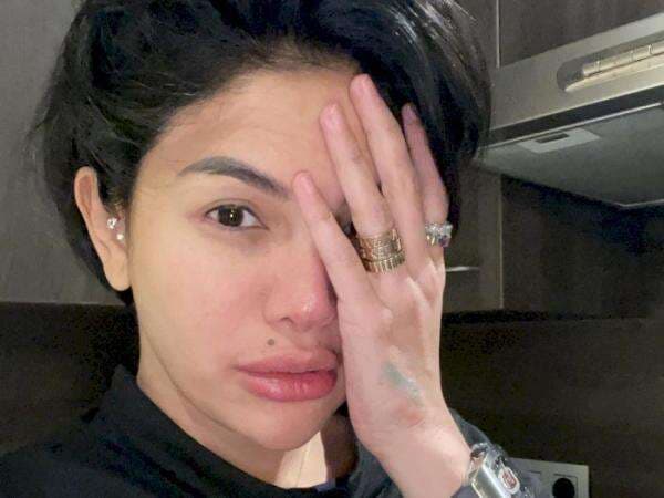 Menang, Nikita Mirzani Khawatir Keadaan Dinar Candy: Gak Apa-apa Mukanya?