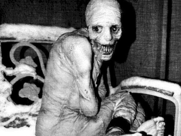 Eksperimen Mengerikan Rusia, Manusia Dipaksa Tidak Tidur Selama 30 Hari dan Hasilnya...