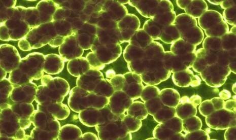 Ilmuwan Temukan Asal-Usul Black Death, Wabah Paling Dahsyat di Dunia