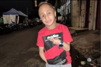 Dicky Topan Meninggal Dunia, Ibunda: Aku Bangga Dititipkan Anak Spesial