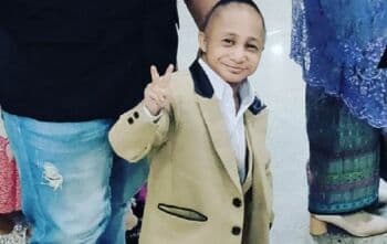 Dicky Topan Alami Pembengkakan Jantung, Apa Saja Penyebabnya?