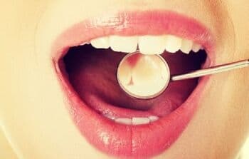 Penyakit Abses Gigi: Penyebab, Gejala dan Cara Mengobati