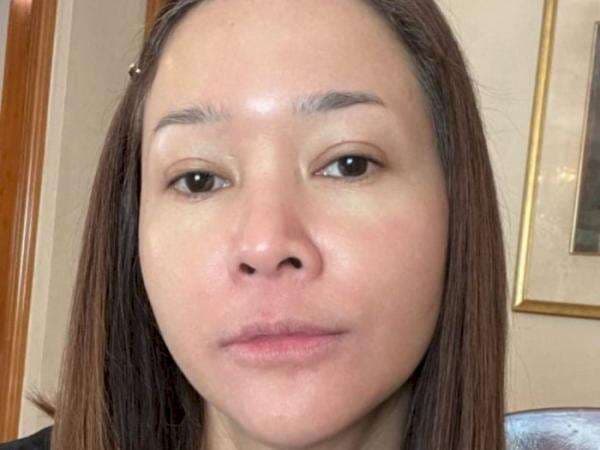 Maia Estianty Pamer Wajah Kemerahan Akibat Penyakit Rosacea, Tetap Cantik Tanpa Makeup
