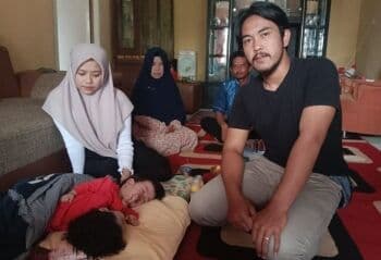 Bayi Kembar Siam, Ayesta dan Aleeya Butuh Bantuan untuk Operasi Pemisahan