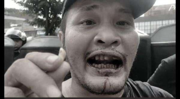 Gigi Copot Dipukul Polisi, Nico Silalahi Segera Lapor Propam