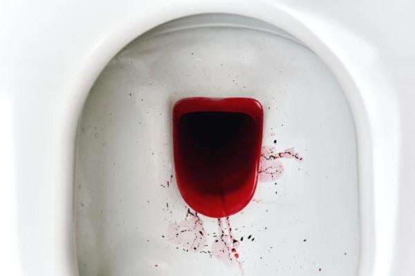 Mengapa Feses Saya Berdarah? Jangan Panik Dulu, Simak Penjelasan Berikut