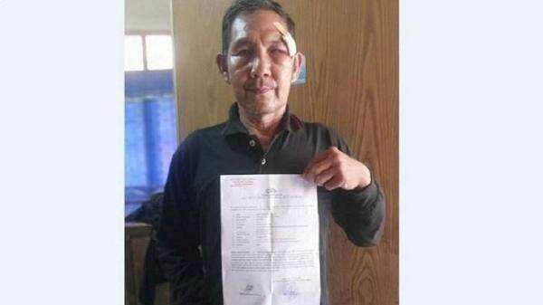 Pensiunan TNI di Lampung Utara Babak Belur Dikeroyok OTK, Dituding Ambil Gambar di SPBU