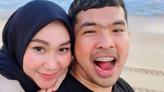 Dikabarkan Sudah Meninggal, Beredar Foto Diduga Istri Pertama Putra Siregar saat di RS, Ruang Perawatan Bikin Miris: Belaga Buta si Putra!