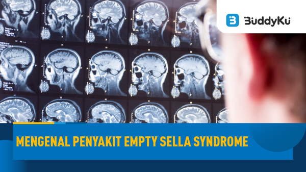 Mengenal Penyakit Empty Sella Syndrome