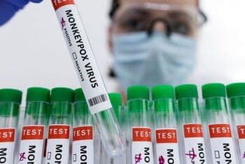 Gejala Cacar Monyet Pertama Kali Pasti Muncul di Alat Kelamin?