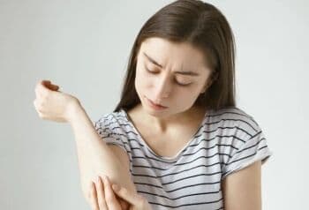 Bisa Menyerang Siapa Saja, Yuk Kenali Cara Mengobati Ringworm!