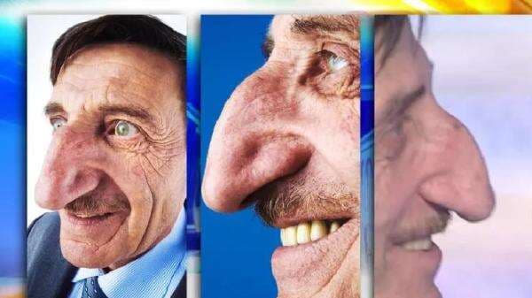 5 Rekor Bagian Tubuh Terpanjang di Dunia, Ada Lidah hingga Rambut Telinga