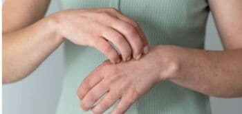 Baby Ameena Halilintar Idap Asma Kulit, Cek 7 Jenis dan Gejalanya