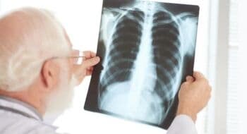 Kenali 10 Gejala Paru-Paru Bocor, Waspadai Sering Sesak Napas