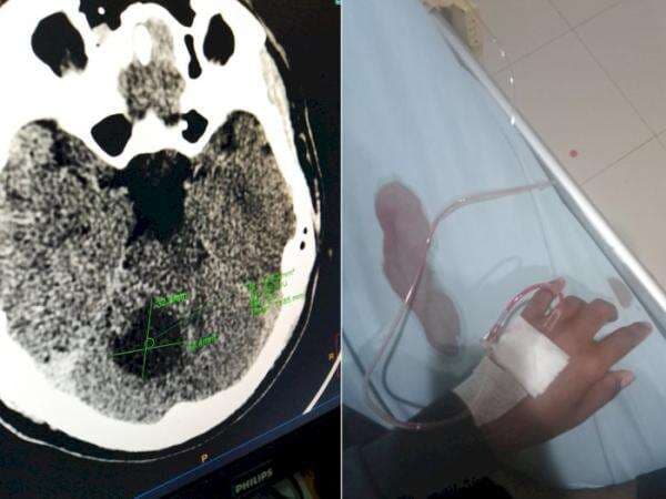 Cuitan Pilu Pasien Tumor Otak di Twitter, Minta Izin Tutup Akun: Umur Gak Lama Lagi